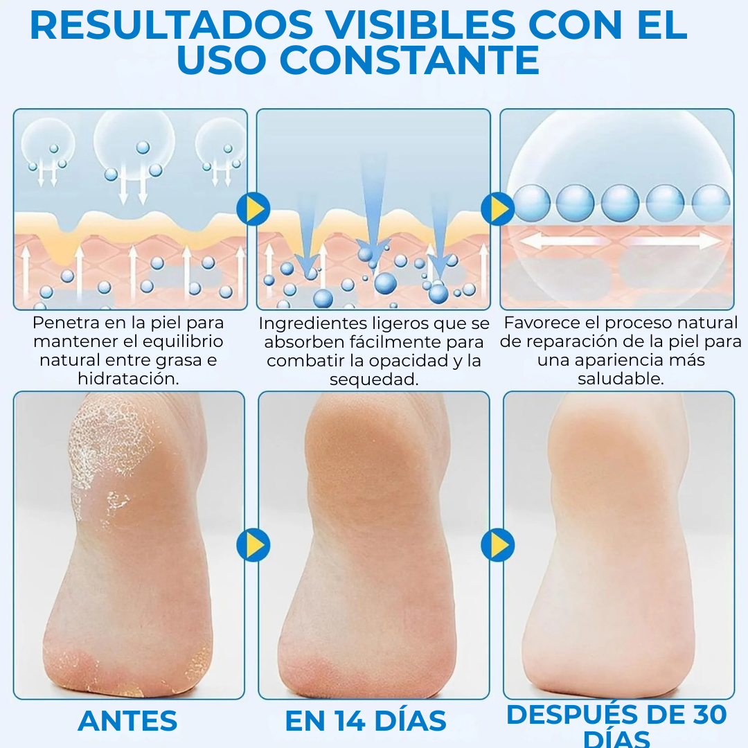 MyCurePro® Reparador de Pies y Talones en Barra