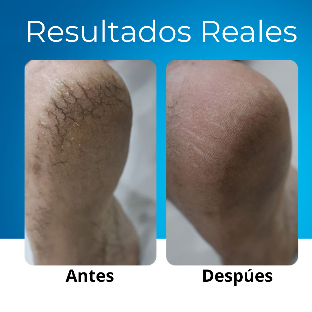 MyCurePro® Reparador de Pies y Talones en Barra