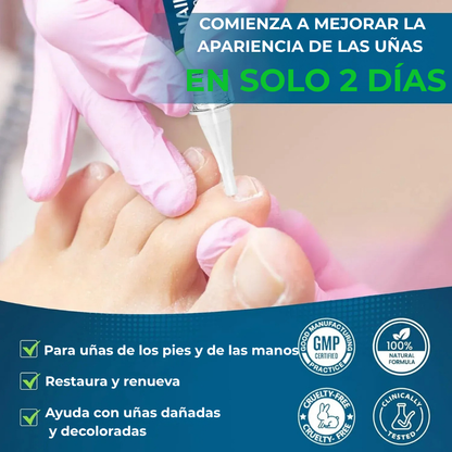 MyCureDerm Lápiz Antifúngico con Fórmula Avanzada – Contra Pie de Atleta y Hongos en Uñas