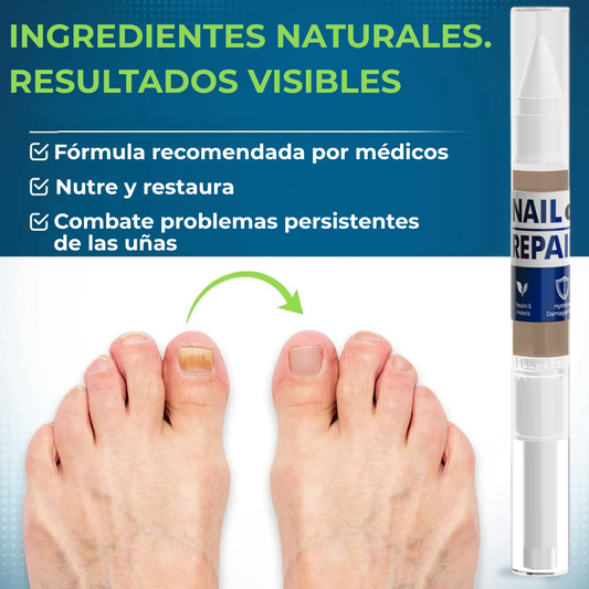 MyCureDerm Lápiz Antifúngico con Fórmula Avanzada – Contra Pie de Atleta y Hongos en Uñas