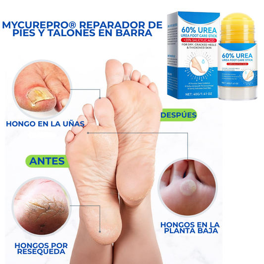 MyCurePro® Reparador de Pies y Talones en Barra