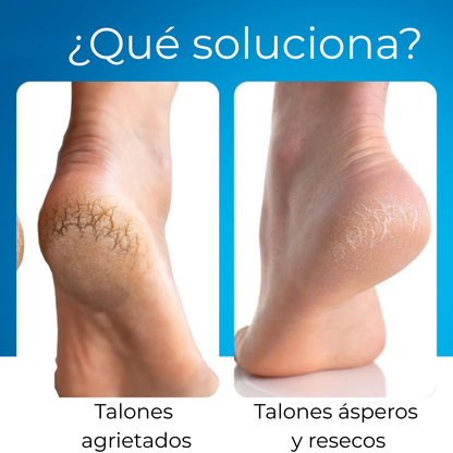 MyCurePro® Reparador de Pies y Talones en Barra