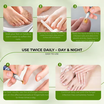 MyCurePro® Antifungal Nail Pen with Advanced Formula – Care for Damaged Nails