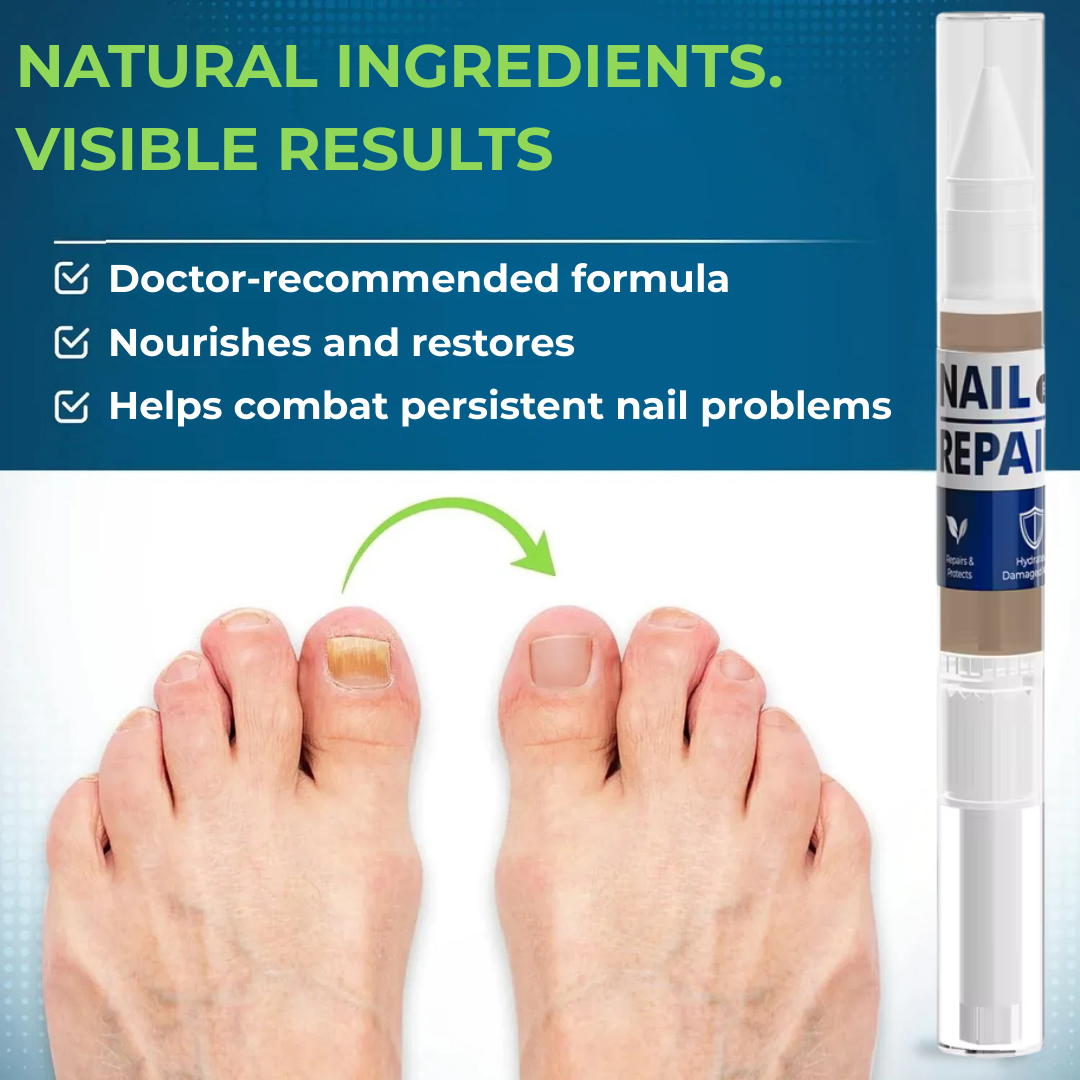 MyCurePro® Antifungal Nail Pen with Advanced Formula – Care for Damaged Nails